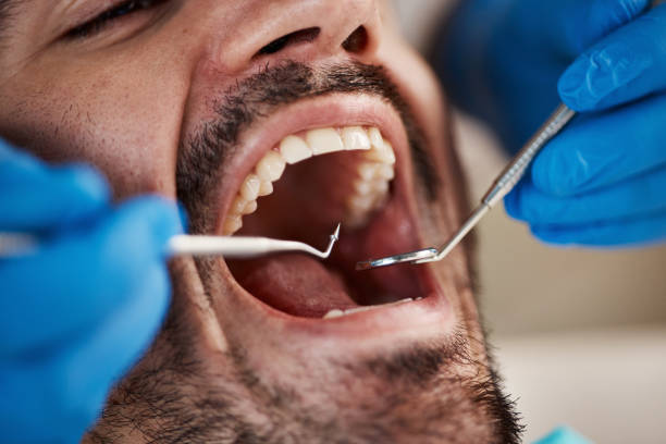Best Emergency Broken Tooth Repair in Oaklyn, NJ
